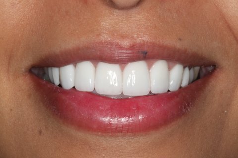 Picture 2 after